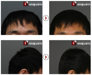 Illustration for article titled "Round Head" Plastic Surgery Seems Excessive, Even for South Korea